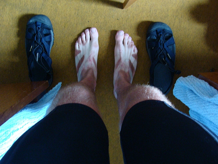 Tigerfeet! The sun has burnt nice dark stripes through my sandals